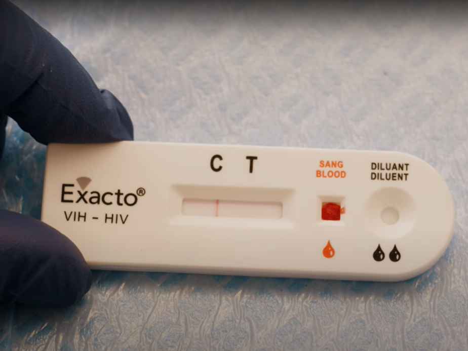 TAI kutsub seksuaalsel teel levivate infektsioonide suhtes testima